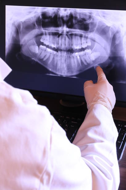 Best Emergency Wisdom Teeth Removal in Angwin, CA
