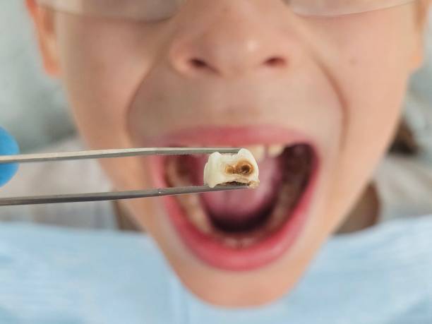 Best 24-Hour Emergency Dentist in Angwin, CA