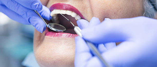 Best After-Hours Dental Trauma Care in Angwin, CA